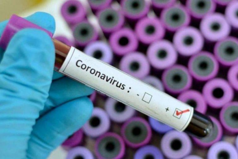 Lee más sobre el artículo UnTER se reúne en Viedma tras la confirmación de un caso de coronavirus en la provincia